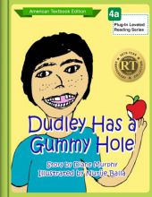 Dudley has a gummy hole